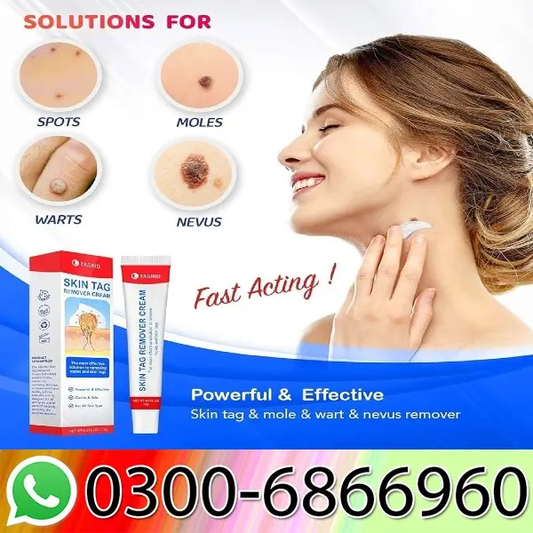 Skin Tags Removal Cream 15g In Pakistan