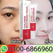 Chalonese Cream Dark Spot Remover & Whitening Cream