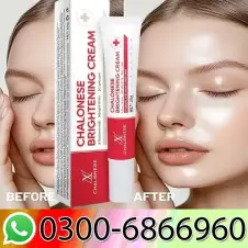 Chalonese Glow Cream in Pakistan