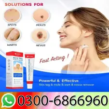 Skin Tags Removal Cream 15g In Pakistan